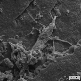 Развитие микромицетов на поверхности мрамора. Виды отдельные споры и гифы,расходящиеся в разных направлениях и образующие сплетение.